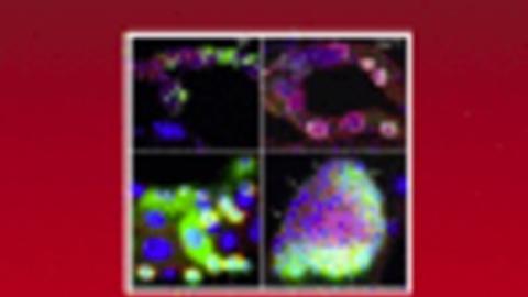 cover design of special issue of Curr Top Dev Biol on fly models of disease